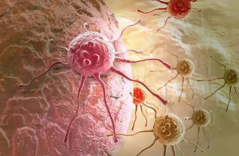 美国医学博士惊人发现：癌细胞最怕“爱”！