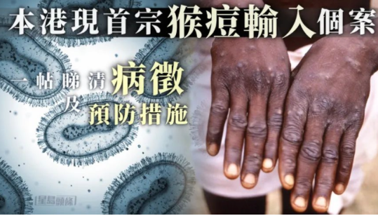 中国三地惊现猴痘感染者!患者:比新冠痛苦100倍